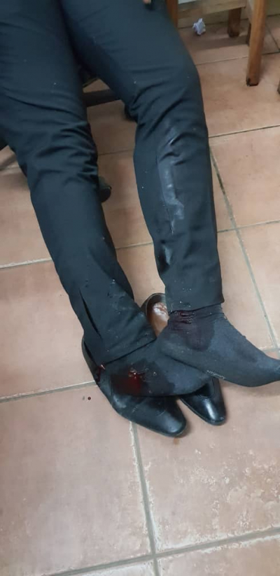 Cameroun : La police brutalise les avocats au palais de justice de Bonanjo à Douala