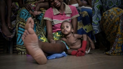 Centrafrique: Les enfants, victimes silencieuses de la guerre