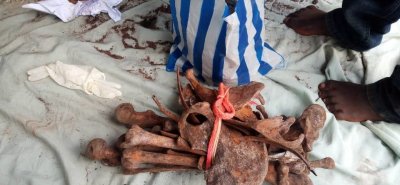 Douala: quatre présumés trafiquants d’ossements humains aux arrêts