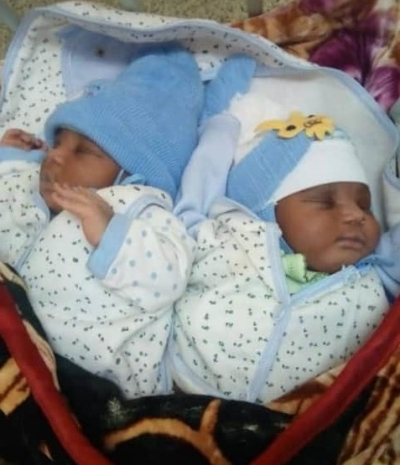 Une déplacée interne de la crise anglophone donne naissance à des bébés siamois
