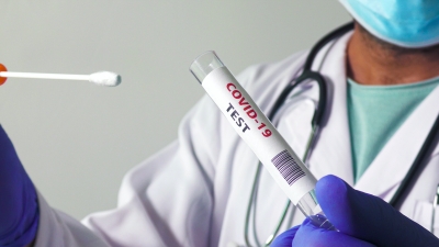 Coronavirus: les tests de dépistage PCR sont désormais payants au Cameroun