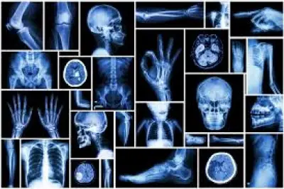 Journée de Radiologie 2019 : Il faut mettre en évidence l&#039;imagerie médicale