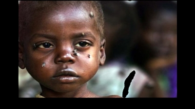 Cameroun/Malnutrition chronique: Les régions septentrionales restent les plus touchées