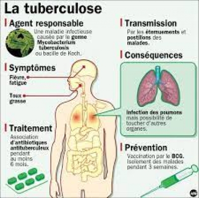 Santé publique: Selon l’Oms les cas de décès suite à la tuberculose sont en nette progression