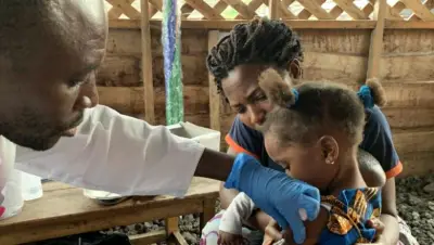 Epidémie de Rougeole : Plus de 1.427 malades de rougeoles et 13 décès enregistrés
