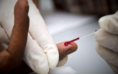Santé : L&#039;Onusida rapporte une baisse de la mortalité liée au VIH/Sida a chuté